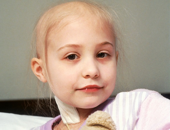 young child losing hair